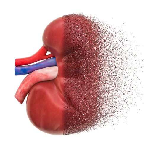 Insuficiencia renal